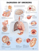 Book cover of: Dangers of Smoking Anatomical Chart. By: Anatomical Chart Company