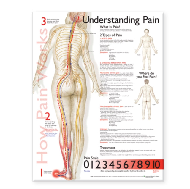 Book cover of: Understanding Pain Anatomical Chart. By: Anatomical Chart Company