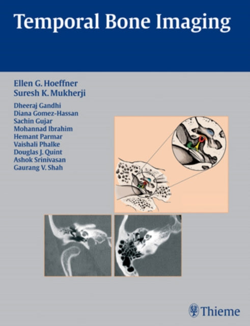 Book cover of: Temporal Bone Imaging