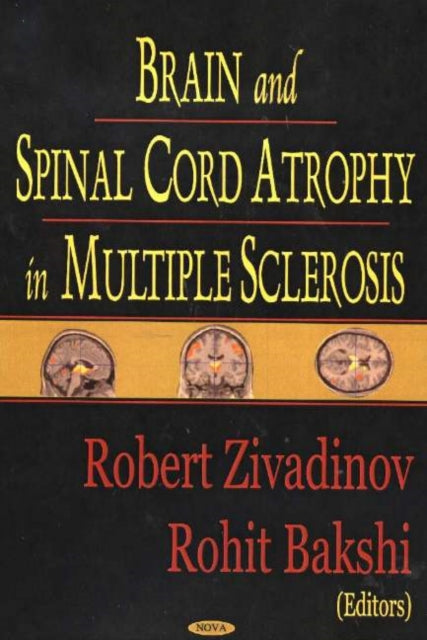 Book cover of: Brain & Spinal Cord Atrophy in Multiple Sclerosis