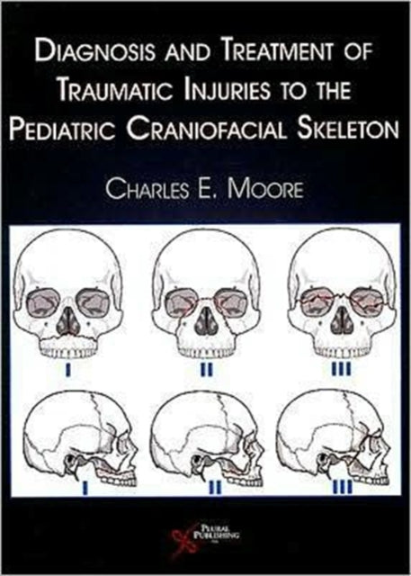 Book cover of: Diagnosis and Treatment of Traumatic Injuries to the Pediatric Craniofacial Skeleton. By: Charles E. Moore