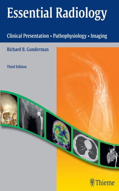 Book cover of: Essential Radiology. By: Richard B. Gunderman