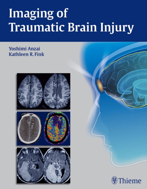 Book cover of: Imaging of Traumatic Brain Injury. By: Yoshimi Anzai
