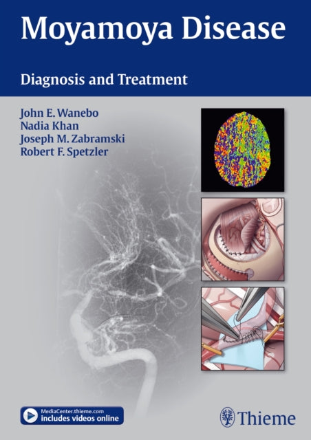 Book cover of: Moyamoya Disease. By: John E. Wanebo
