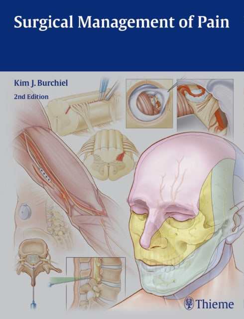 Book cover of: Surgical Management of Pain. By: Kim J. Burchiel