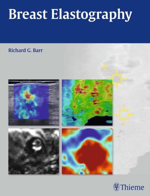 Book cover of: Breast Elastography. By: Richard G. Barr