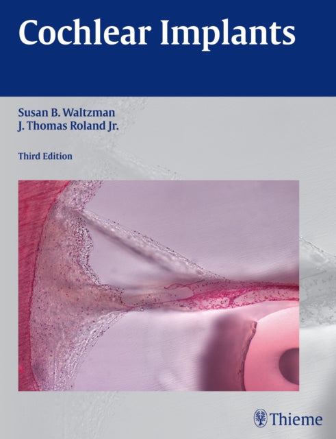 Book cover of: Cochlear Implants. By: Susan B. Waltzman