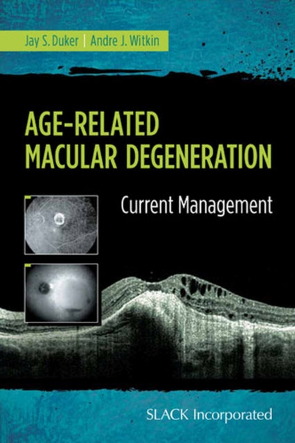 Book cover of: Age-Related Macular Degeneration. By: Jay S. Duker