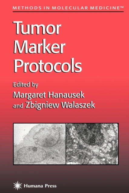 Book cover of: Tumor Marker Protocols. By: Margaret Hanausek