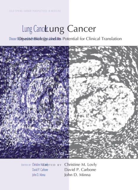 Book cover of: Lung Cancer: Disease Biology and Its Potential for Clinical Translation. By: John Minna