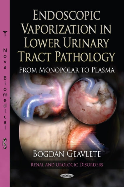 Book cover of: Endoscopic Vaporization in Lower Urinary Tract Pathology from Monopolar to Plasma. By: Bogdan Florin Geavlete