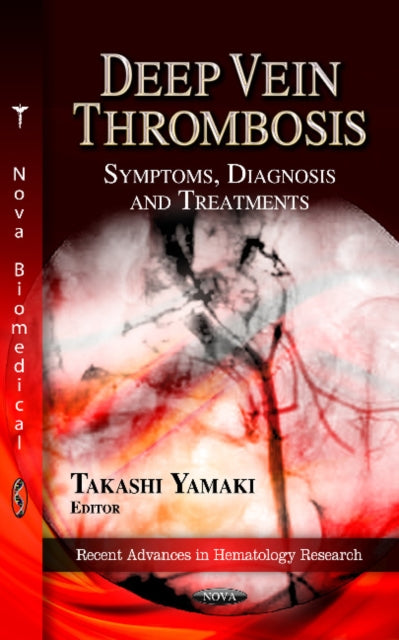 Book cover of: Deep Vein Thrombosis