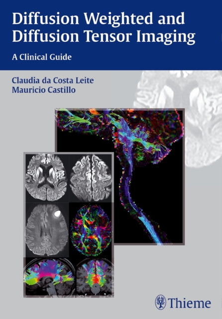 Book cover of: Diffusion Weighted and Diffusion Tensor Imaging. By: Mauricio Castillo