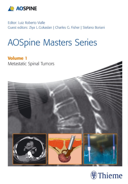Book cover of: AOSpine Masters Series Volume 1: Metastatic Spinal Tumors. By: Luiz Roberto Gomes Vialle