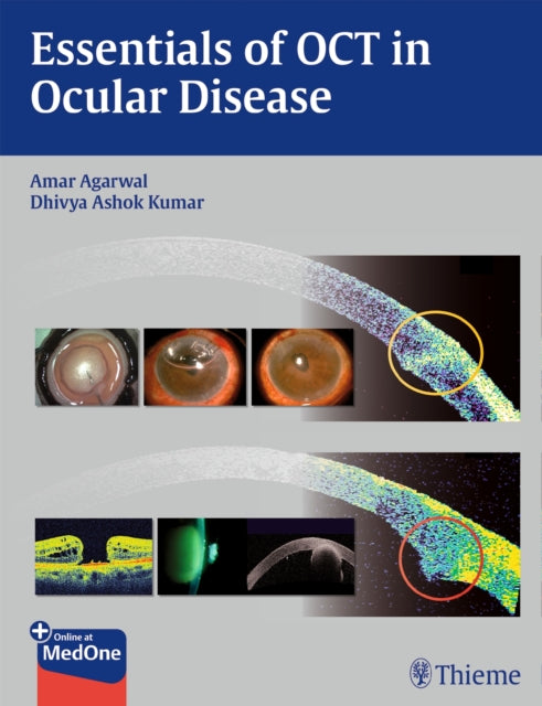 Book cover of: Essentials of OCT in Ocular Disease. By: Amar Agarwal