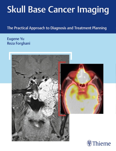 Book cover of: Skull Base Cancer Imaging. By: Eugene Yu