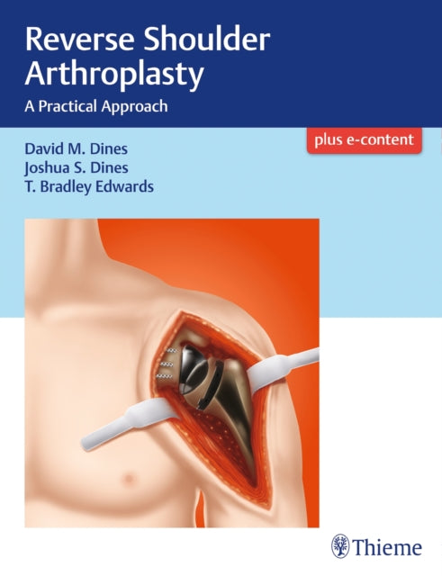 Book cover of: Reverse Shoulder Arthroplasty. By: David M. Dines