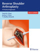 Book cover of: Reverse Shoulder Arthroplasty. By: David M. Dines