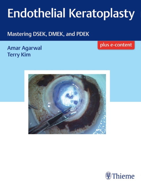 Book cover of: Endothelial Keratoplasty. By: Amar Agarwal