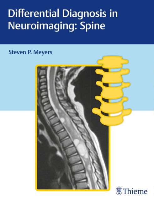 Book cover of: Differential Diagnosis in Neuroimaging: Spine. By: Steven P. Meyers