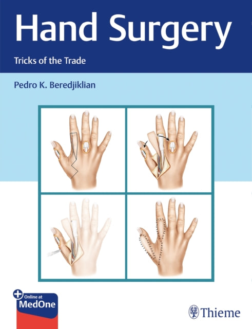 Book cover of: Hand Surgery. By: Pedro Beredjiklian