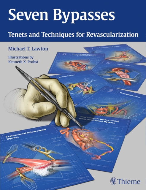 Book cover of: Seven Bypasses. By: Michael T. Lawton