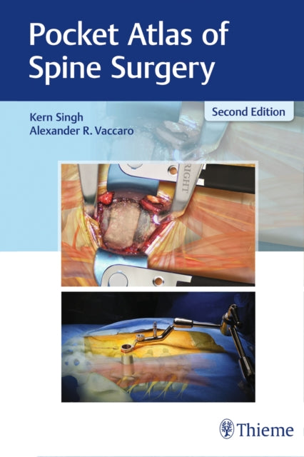 Book cover of: Pocket Atlas of Spine Surgery. By: Kern Singh