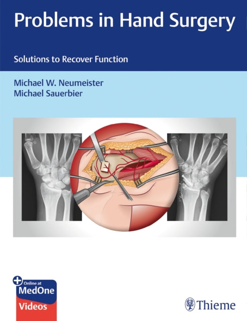 Book cover of: Problems in Hand Surgery. By: Michael Neumeister