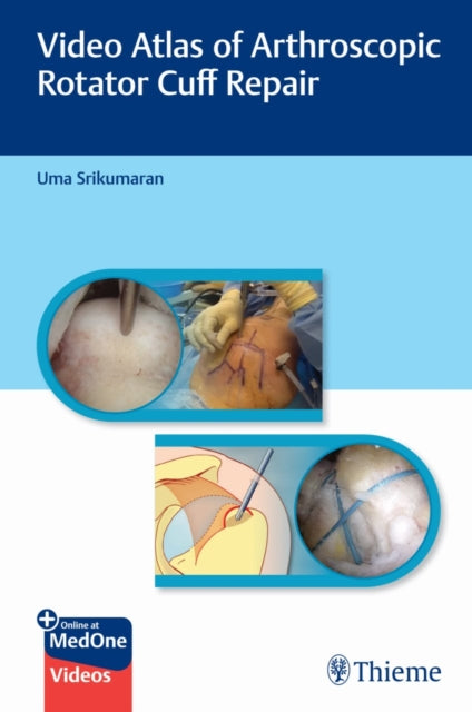 Book cover of: Video Atlas of Arthroscopic Rotator Cuff Repair. By: Uma Srikumaran