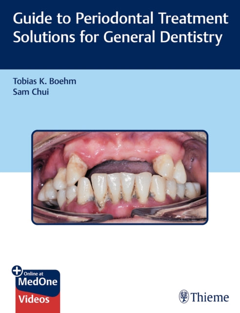 Book cover of: Guide to Periodontal Treatment Solutions for General Dentistry. By: Tobias Boehm