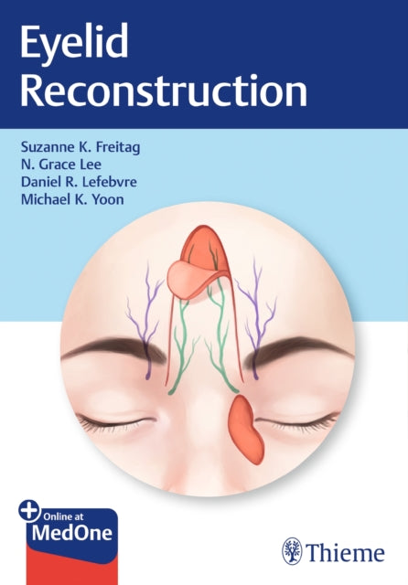 Book cover of: Eyelid Reconstruction. By: Suzanne Freitag