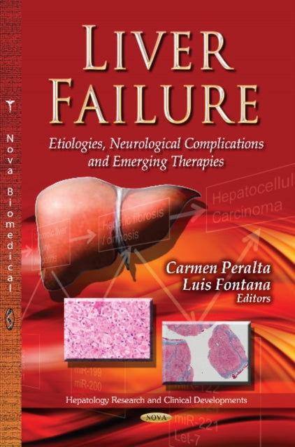 Book cover of: Liver Failure. By: Carmen Peralta