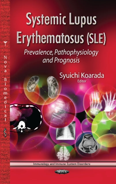 Book cover of: Systemic Lupus Erythematosus (SLE). By: Syuichi Koarada