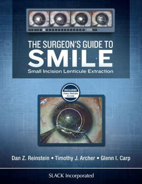 Book cover of: Surgeon’s Guide to SMILE. By: Dan Z. Reinstein