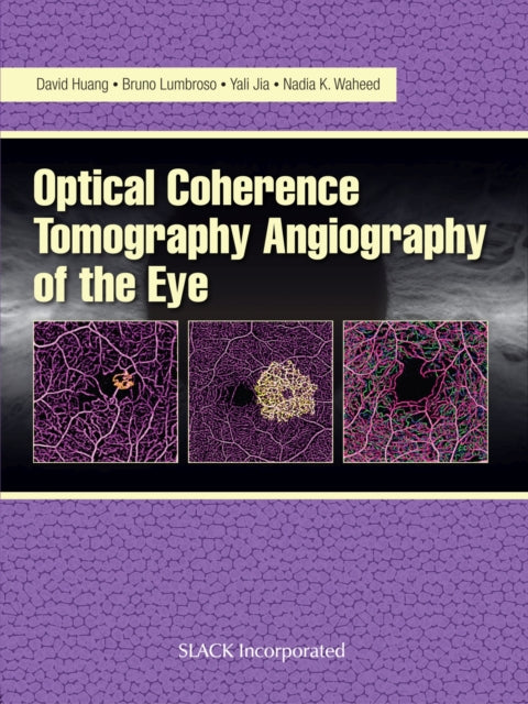 Book cover of: Optical Coherence Tomography Angiography of the Eye. By: David Huang