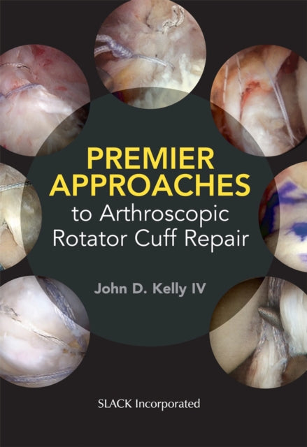 Book cover of: Premier Approaches to Arthroscopic Rotator Cuff Repair. By: John Kelly