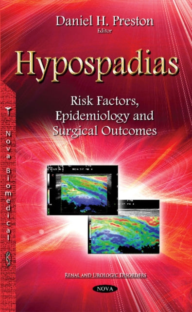 Book cover of: Hypospadias. By: Daniel H. Preston