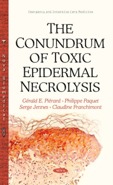Book cover of: Conundrum of Toxic Epidermal Necrolysis. By: Gérald E. Piérard