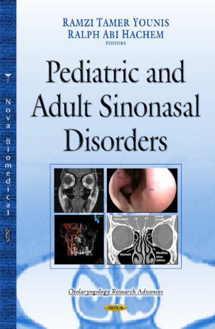 Book cover of: Paranasal Sinuses. By: Ramzi Tamer Younis