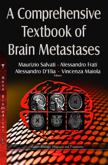 Book cover of: Comprehensive Textbook of Brain Metastases. By: Maurizio Salvati