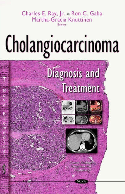 Book cover of: Cholangiocarcinoma. By: Charles E. Ray