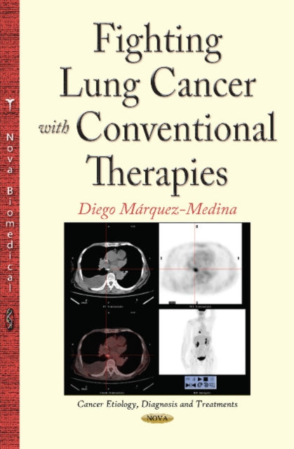 Book cover of: Fighting Lung Cancer with Conventional Therapies. By: Diego Márquez-Medina
