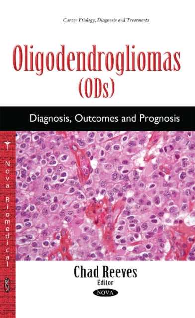 Book cover of: Oligodendrogliomas (ODs). By: Chad Reeves