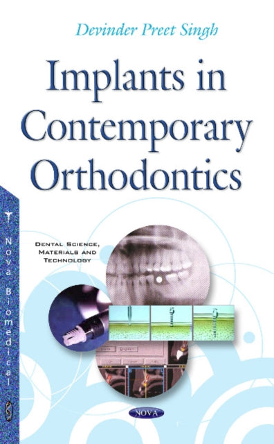 Book cover of: Implants in Contemporary Orthodontics. By: Devinder Preet Singh
