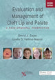 Book cover of: Evaluation and Management of Cleft Lip and Palate. By: David J. Zajac