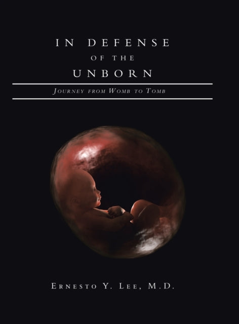 Book cover of: In Defense of the Unborn