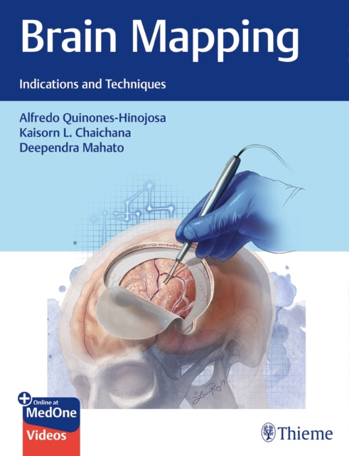 Book cover of: Brain Mapping. By: Alfredo Quinones-Hinojosa