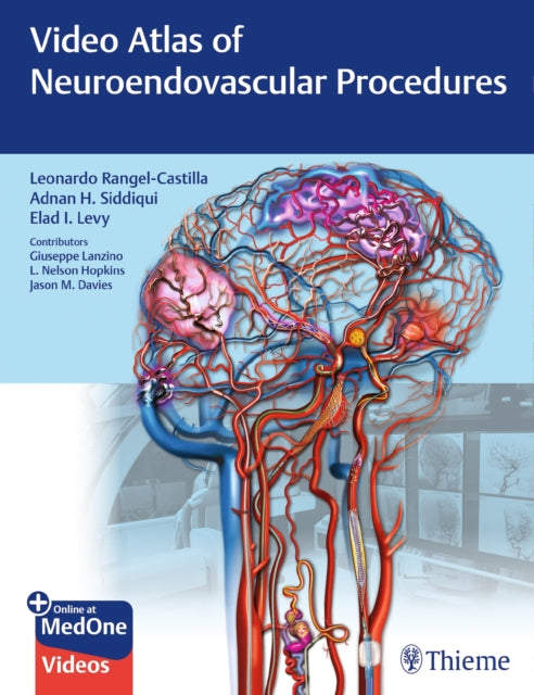 Book cover of: Video Atlas of Neuroendovascular Procedures. By: Leonardo Rangel-Castilla