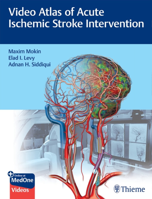 Book cover of: Video Atlas of Acute Ischemic Stroke Intervention. By: Maxim Mokin