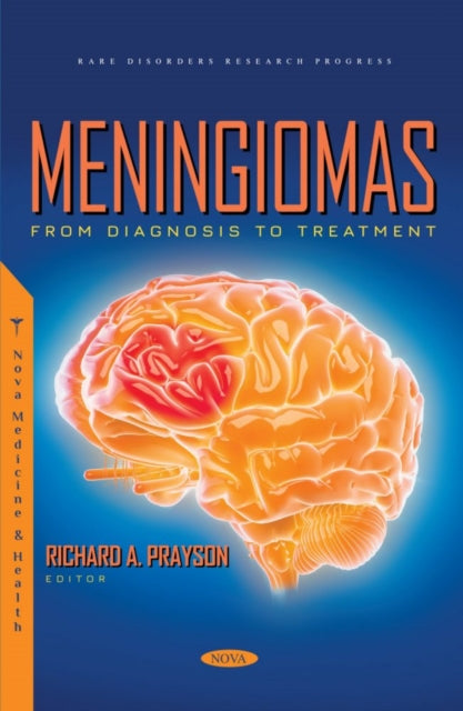 Book cover of: Meningiomas. By: Richard A. Prayson